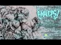 Analepsy - Viral Disease